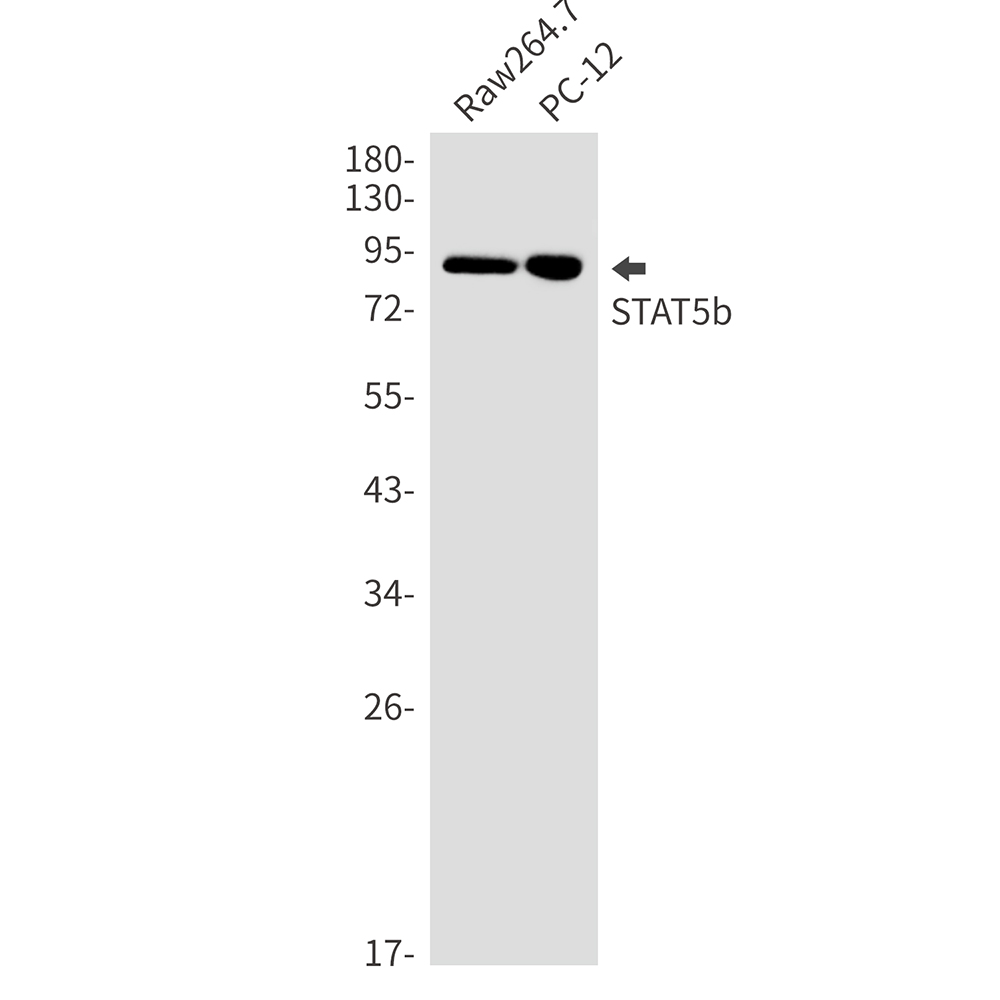 STAT5b Rabbit mAb