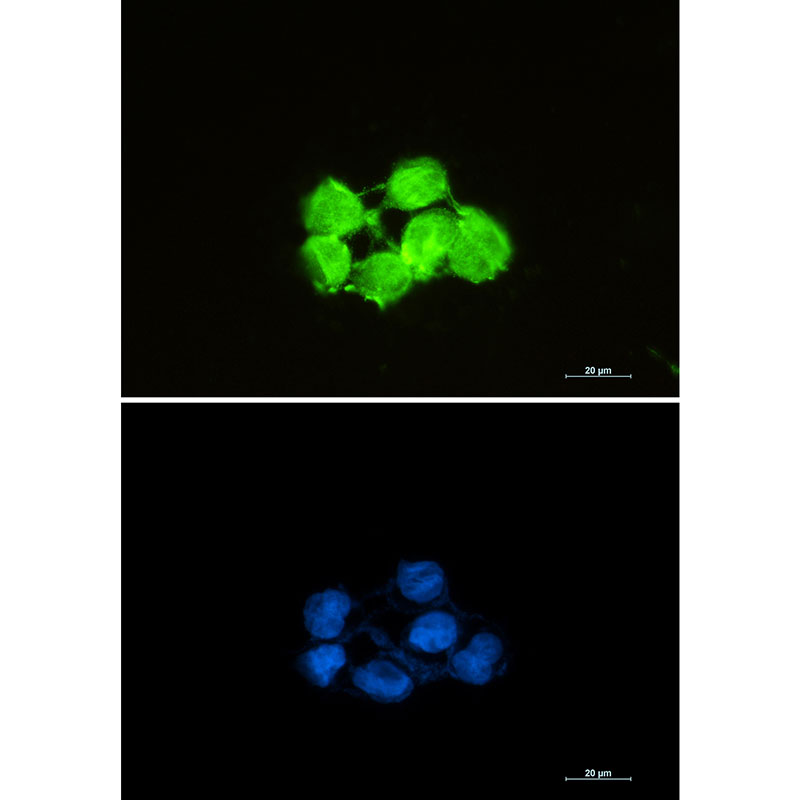 Superoxide Dismutase 1 Rabbit mAb