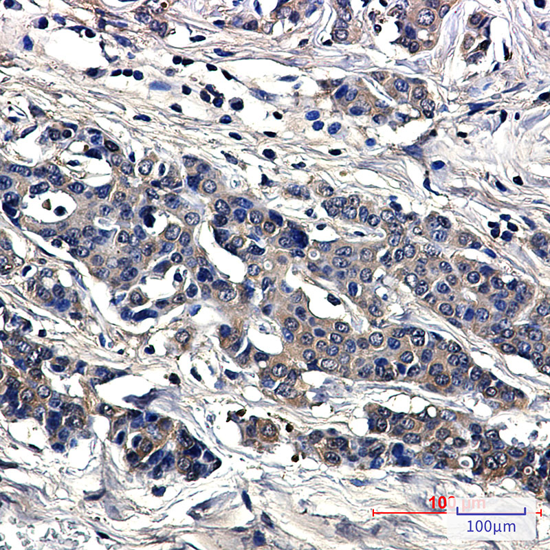 Superoxide Dismutase 1 Rabbit mAb