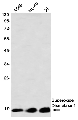 Superoxide Dismutase 1 Rabbit mAb