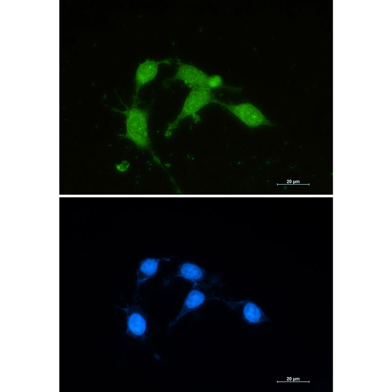 Superoxide Dismutase 1 Rabbit mAb