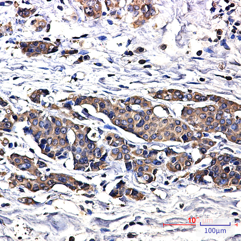 Superoxide Dismutase 1 Rabbit mAb