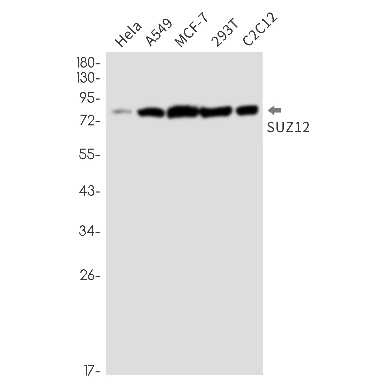 Polycomb Protein SUZ12 Rabbit mAb