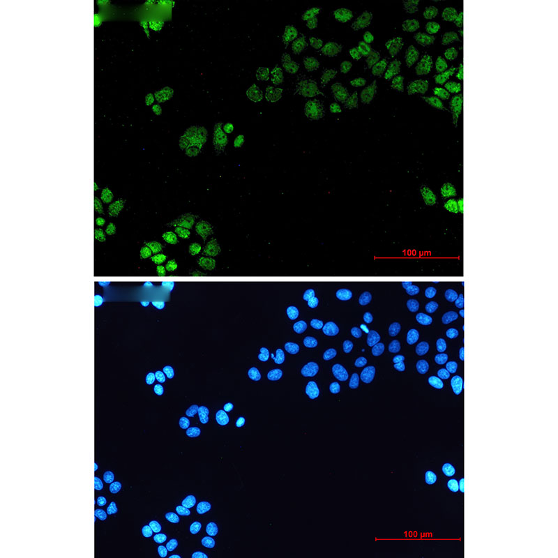 TATA Box Binding Protein Rabbit mAb