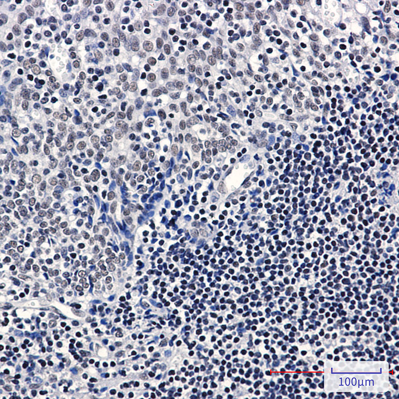 TATA Box Binding Protein Rabbit mAb