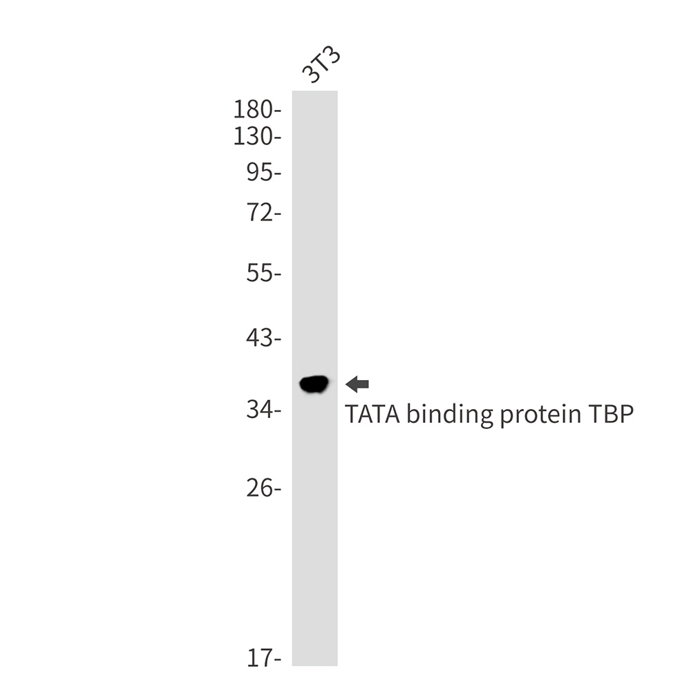 TATA Box Binding Protein Rabbit mAb