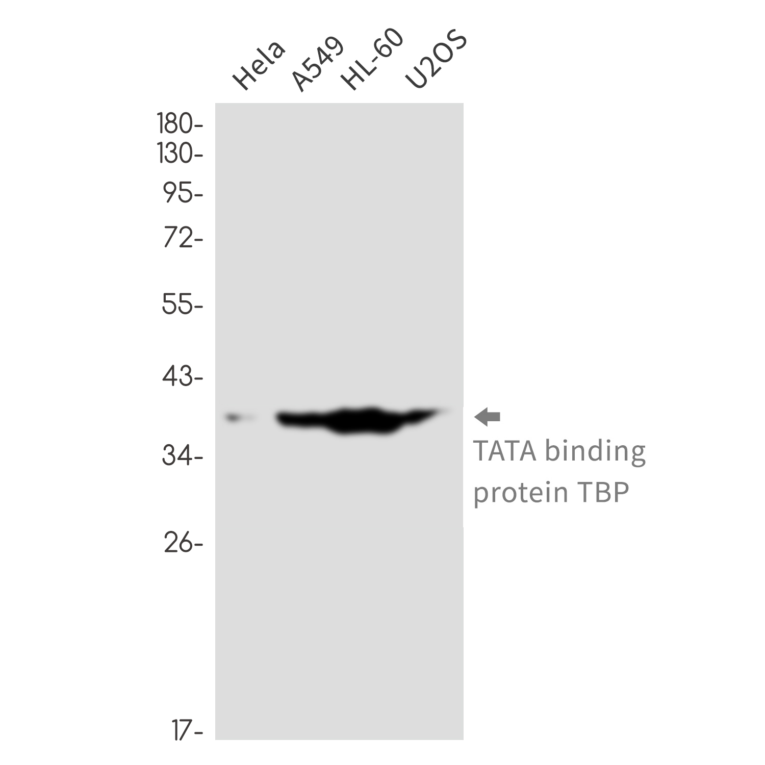 TATA Box Binding Protein Rabbit mAb