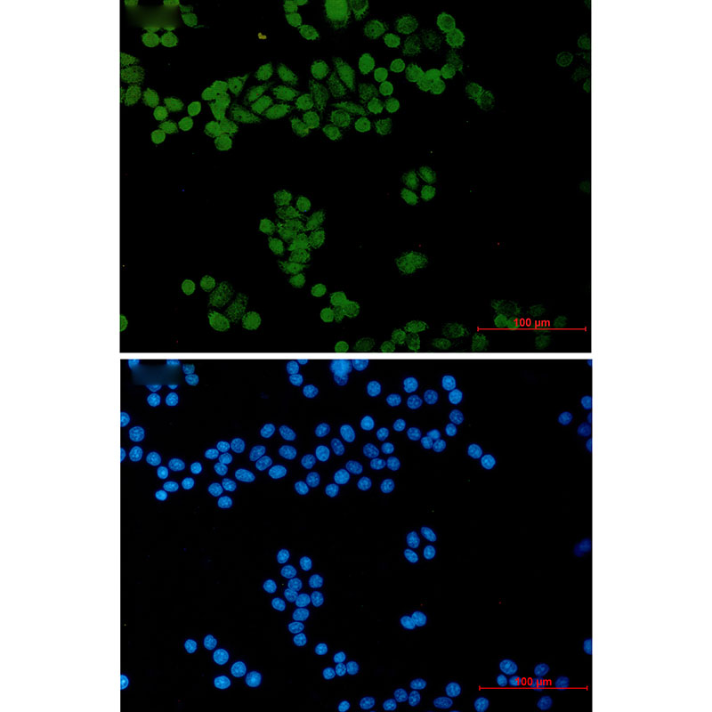 General Transcription Factor II I Rabbit mAb