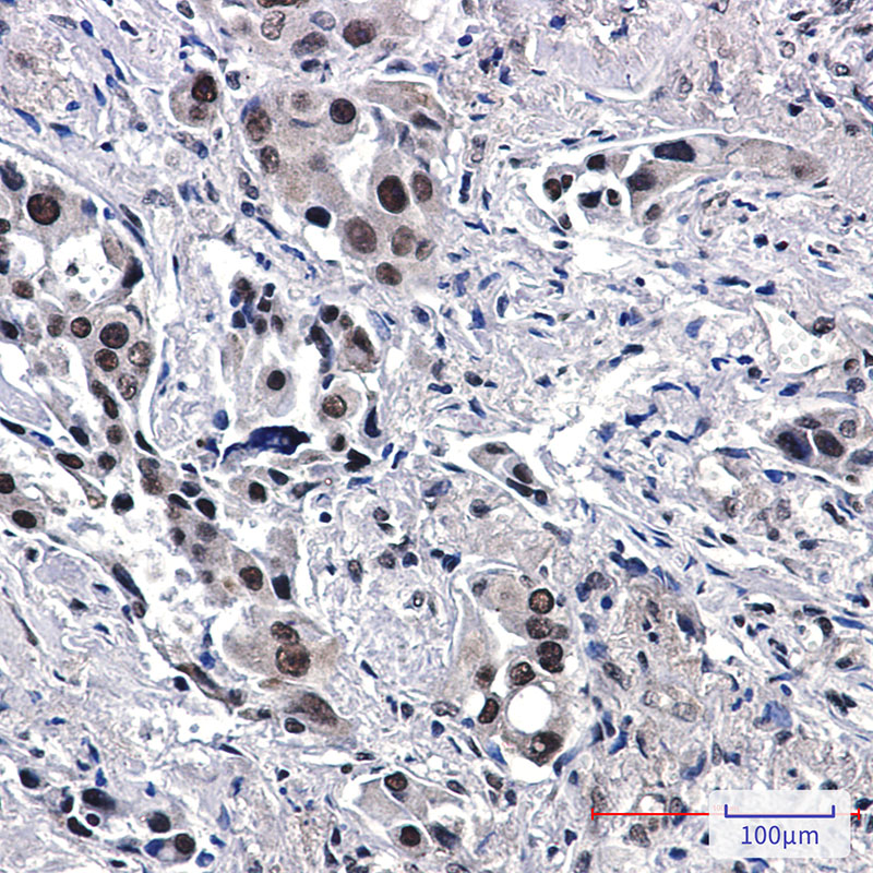 General Transcription Factor II I Rabbit mAb