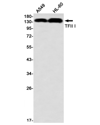 General Transcription Factor II I Rabbit mAb