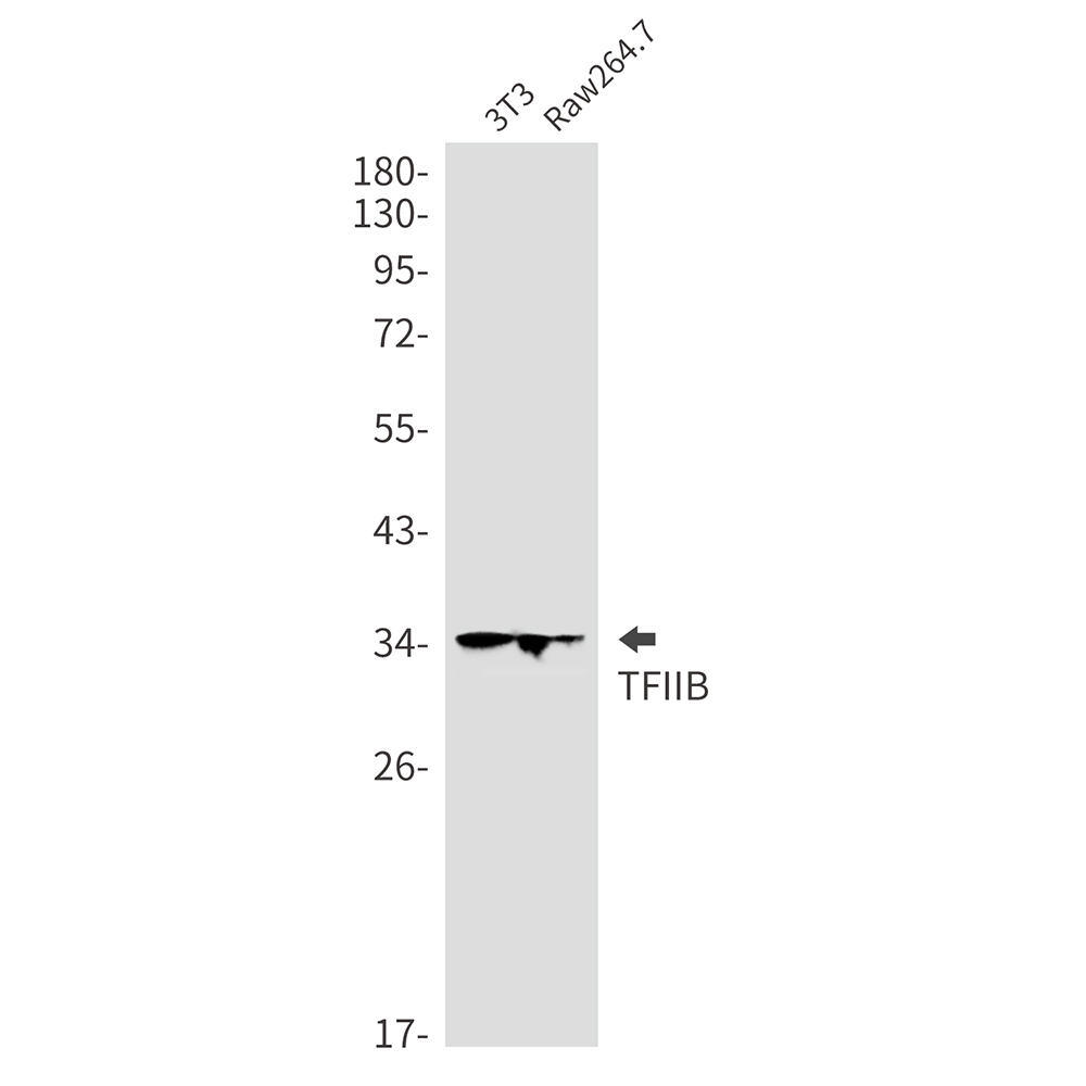 Transcription Initiation Factor IIB Rabbit mAb