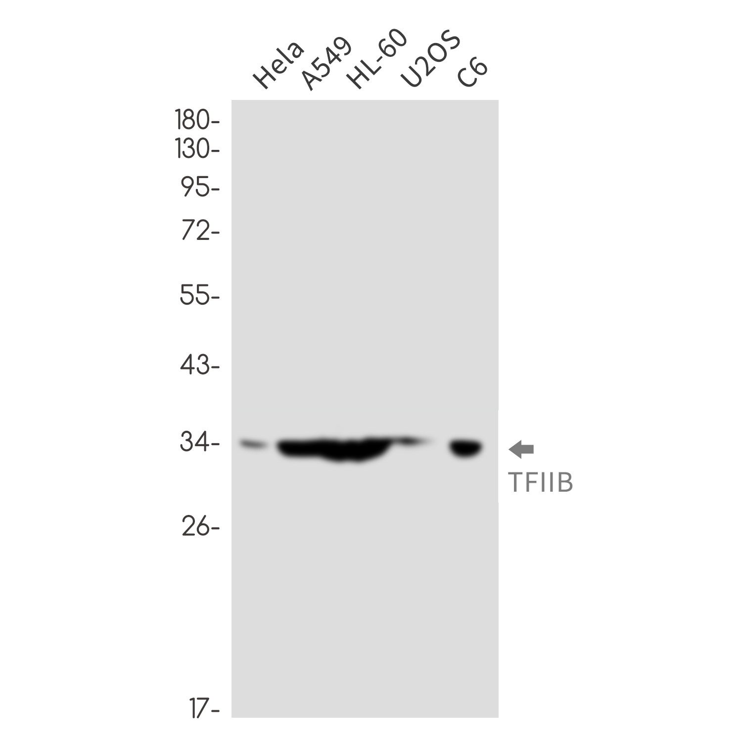 Transcription Initiation Factor IIB Rabbit mAb