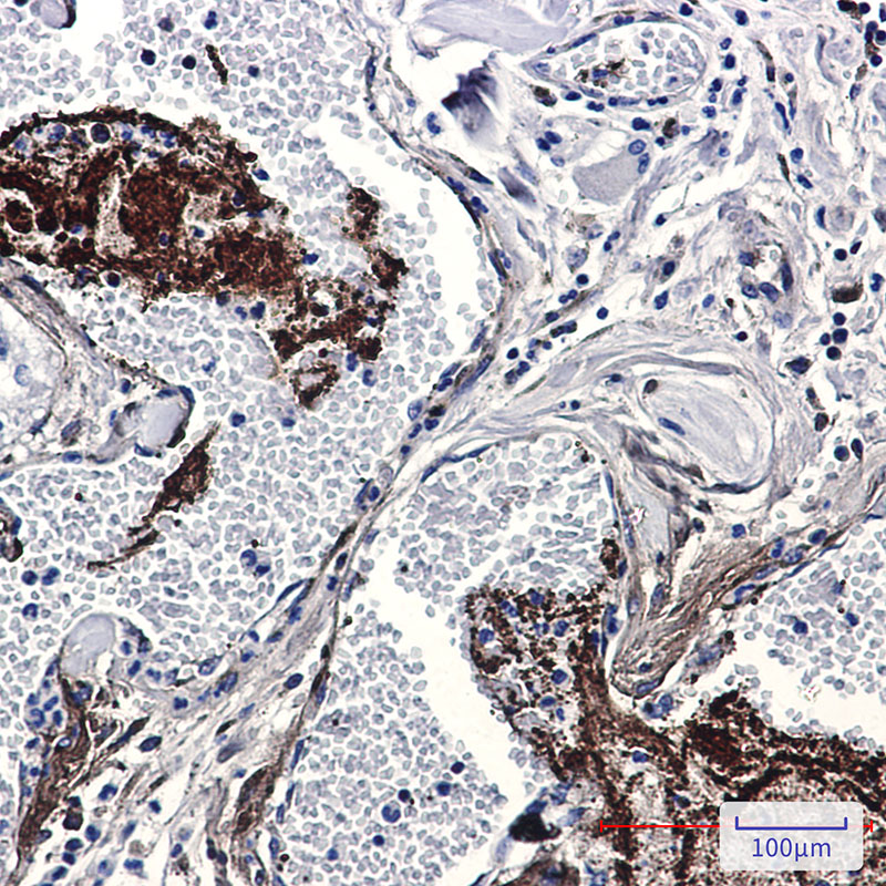 Thrombospondin 1 Rabbit mAb