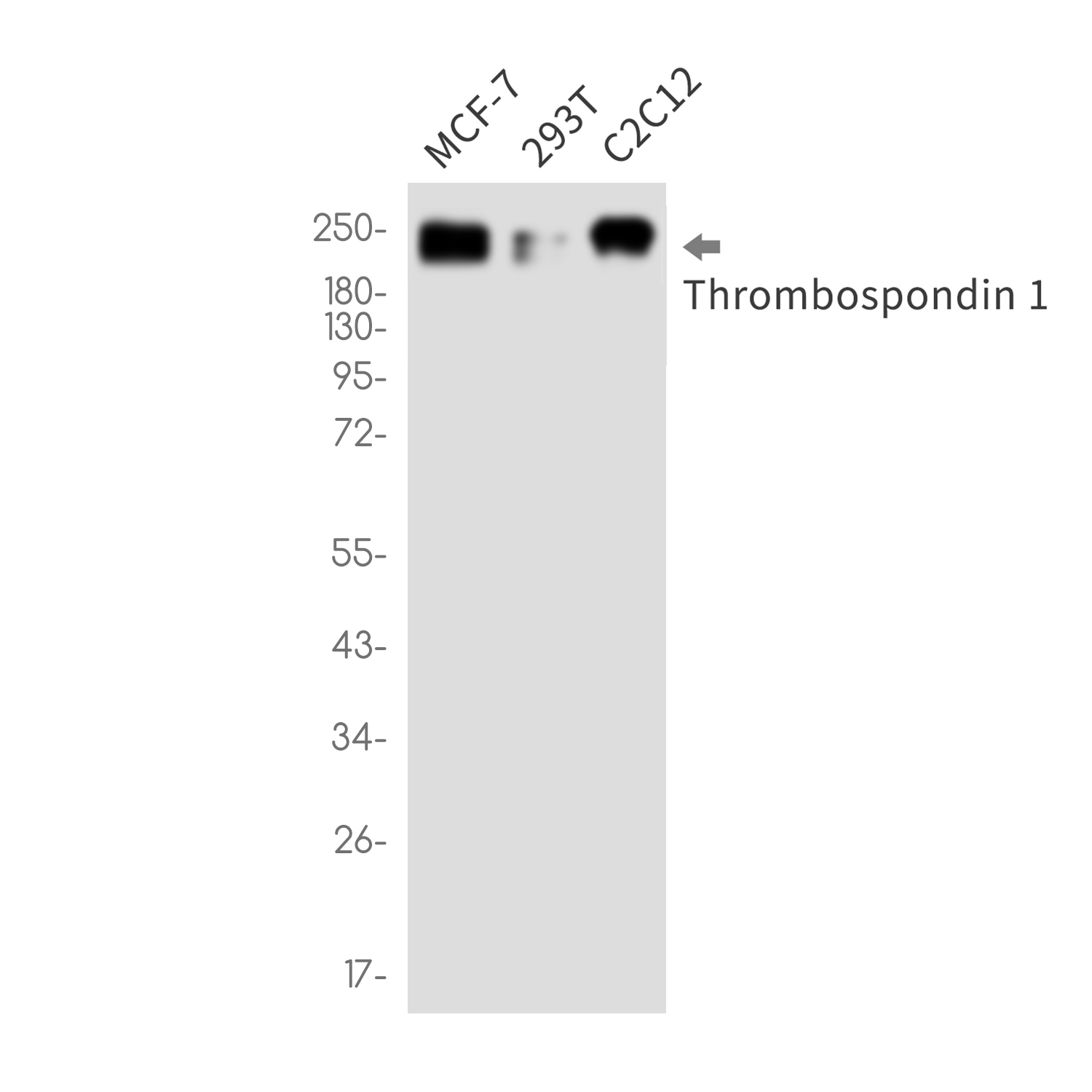 Thrombospondin 1 Rabbit mAb