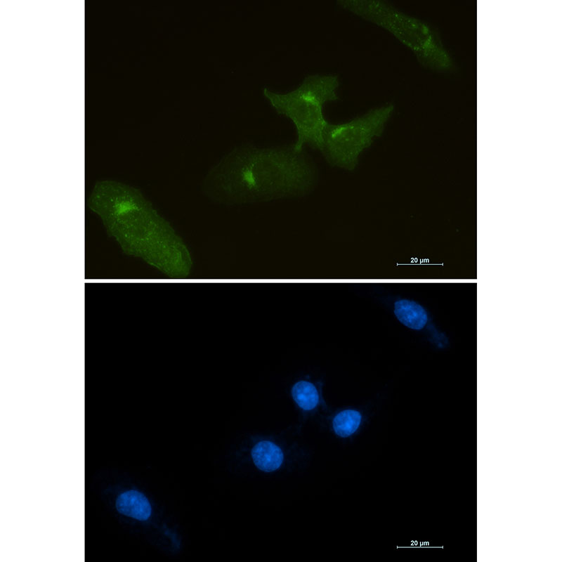 Tissue Factor Rabbit mAb