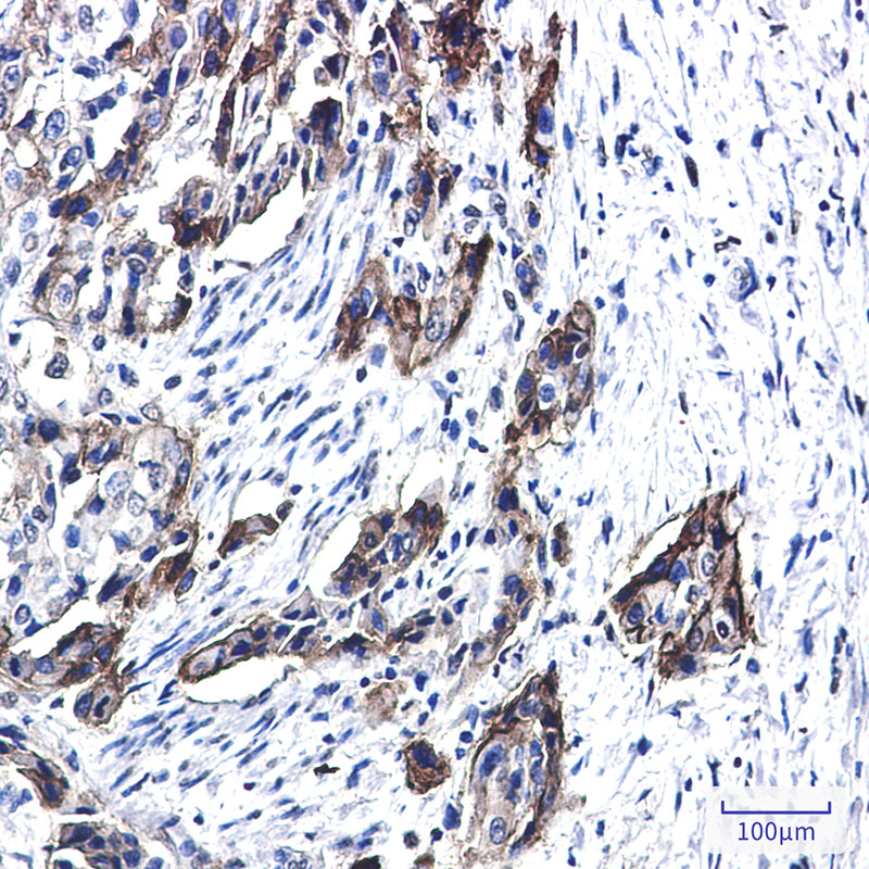 Tissue Factor Rabbit mAb