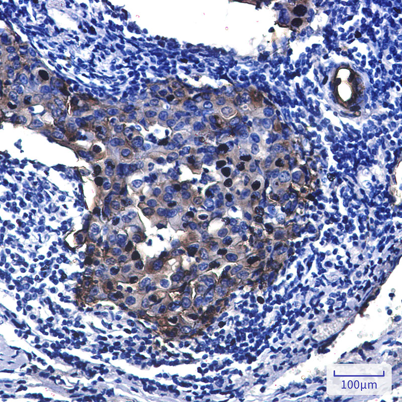 Tissue Factor Rabbit mAb