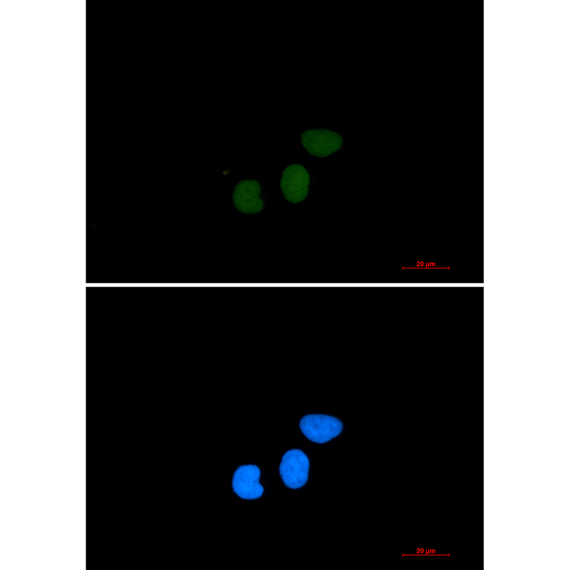 TPX2 Rabbit mAb