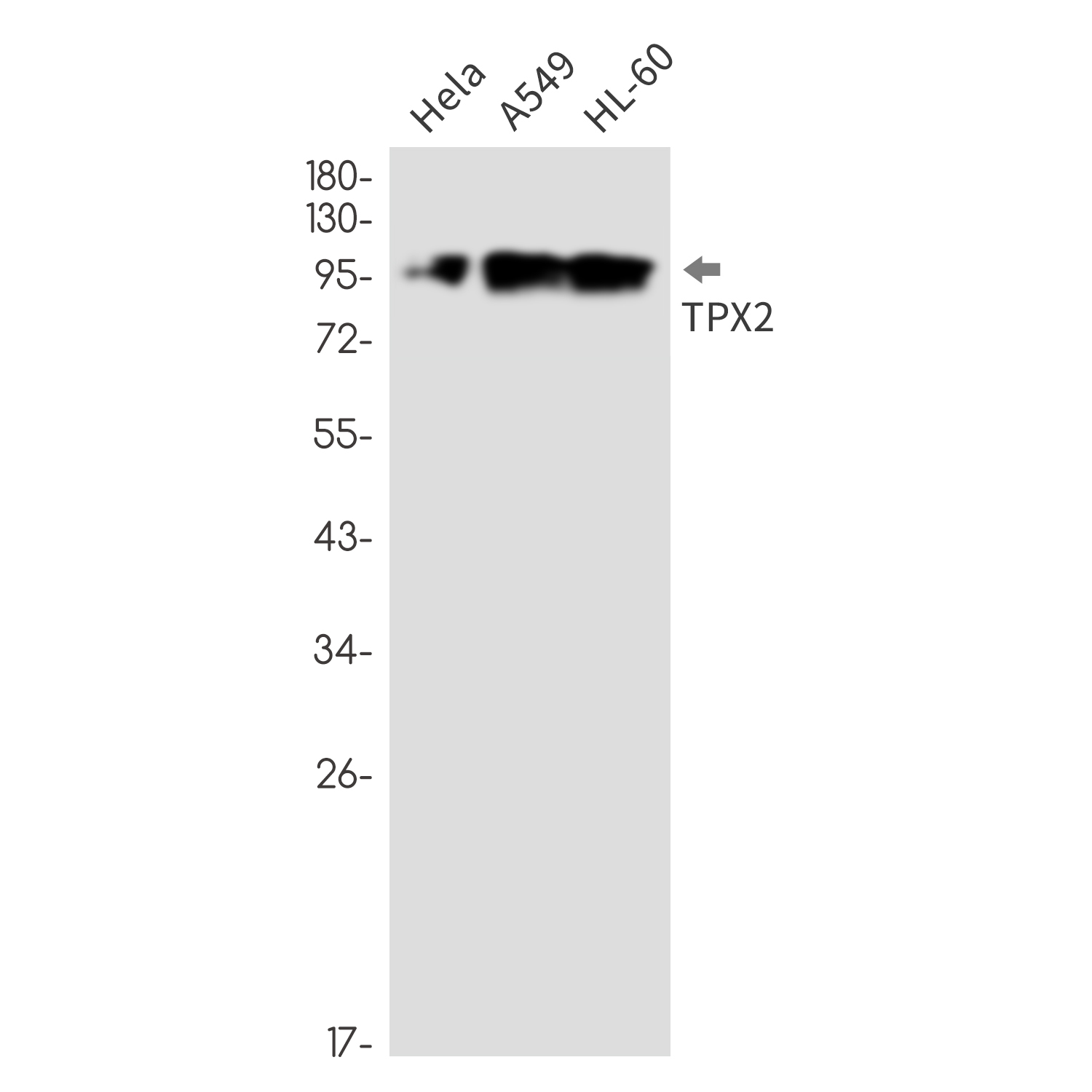 TPX2 Rabbit mAb