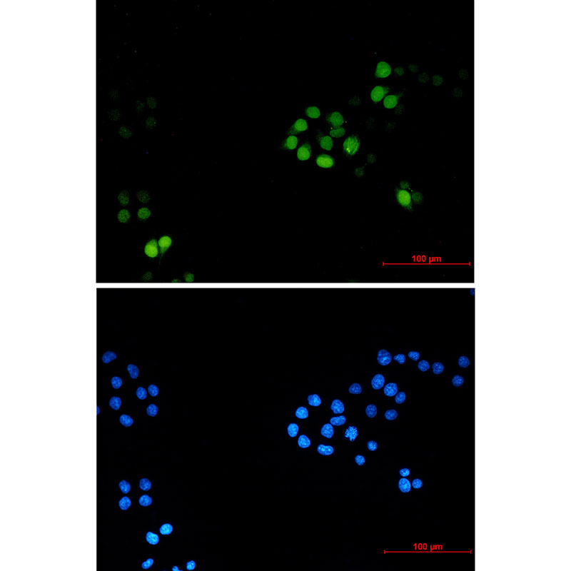 TPX2 Rabbit mAb