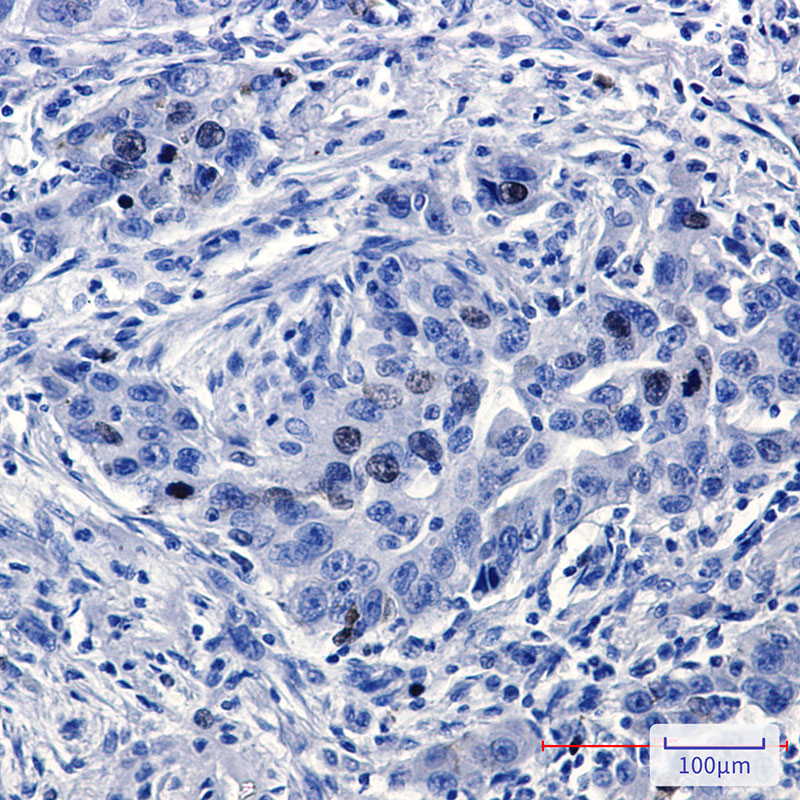 TPX2 Rabbit mAb