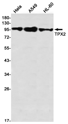 TPX2 Rabbit mAb