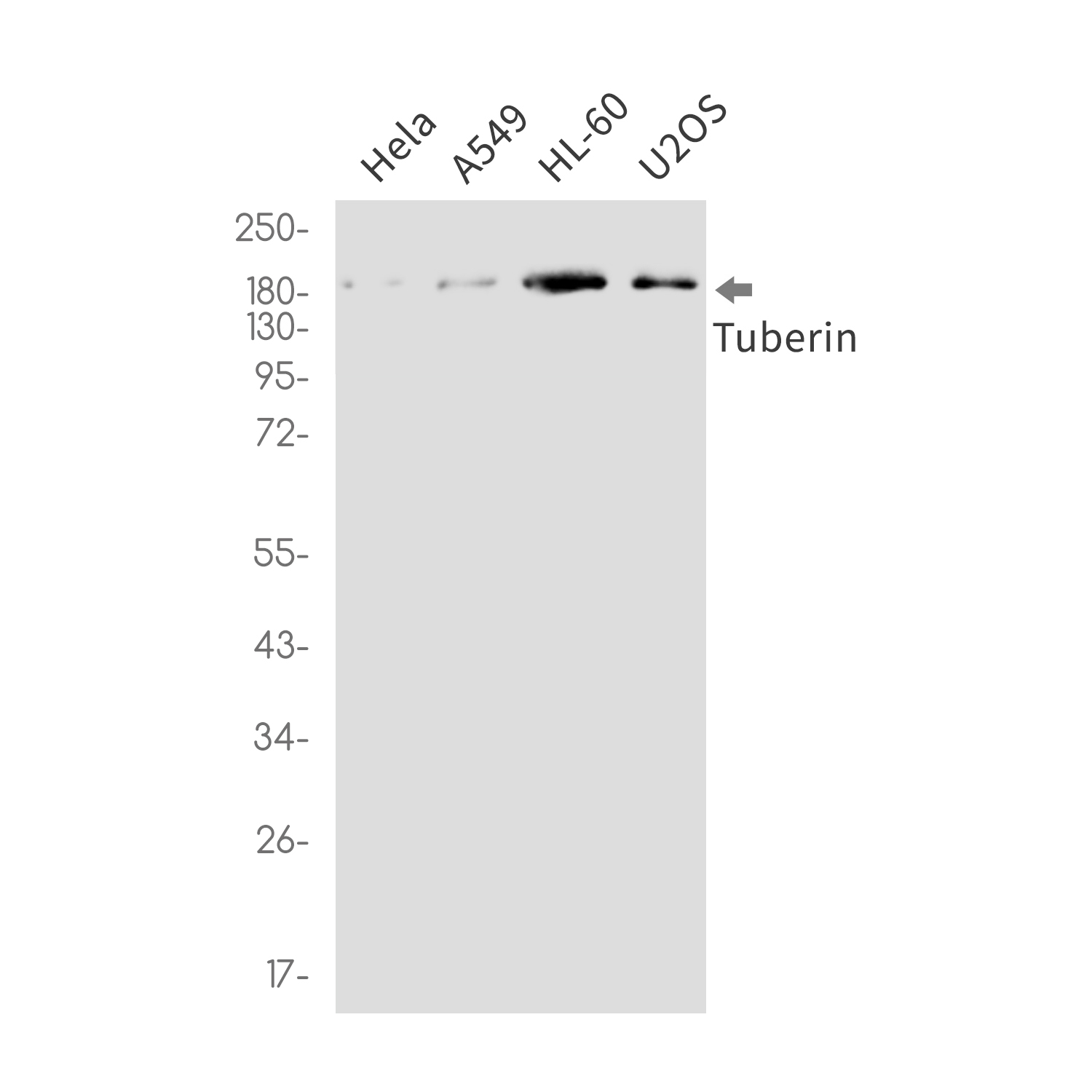 Tuberin Rabbit mAb