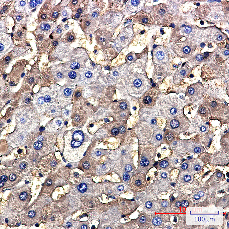 Tuberin Rabbit mAb