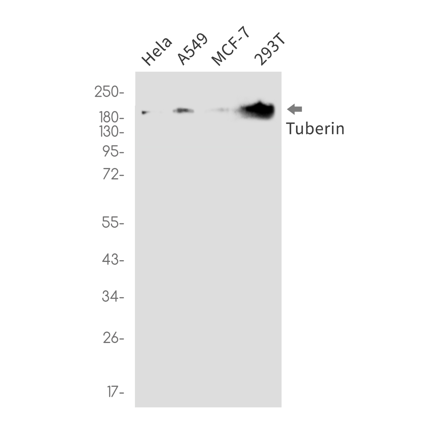 Tuberin Rabbit mAb