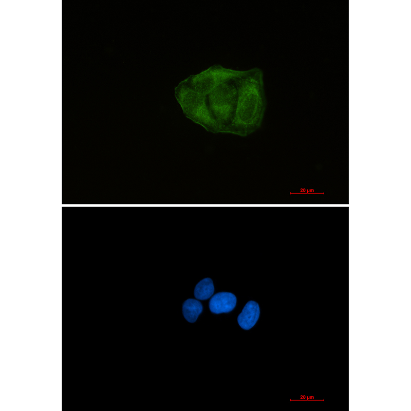 Ubiquitin 60S Ribosomal Protein L40 Rabbit mAb