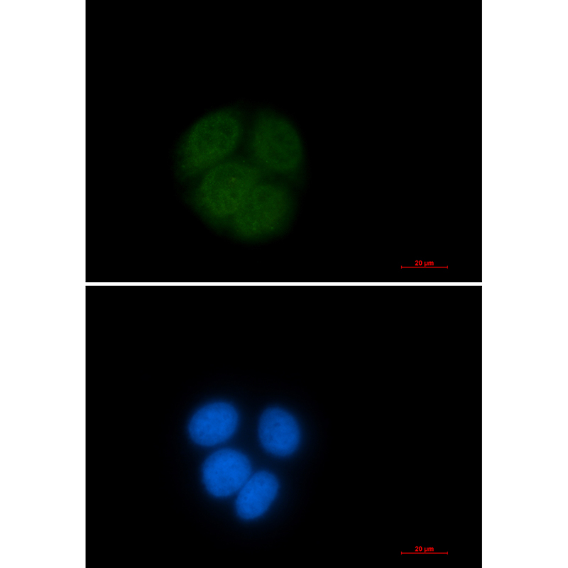 Ubiquitin Conjugating Enzyme E2 C Rabbit mAb