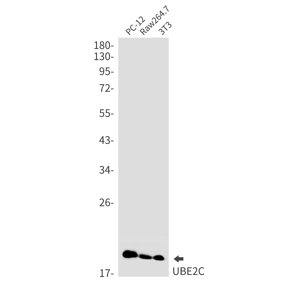 Ubiquitin Conjugating Enzyme E2 C Rabbit mAb