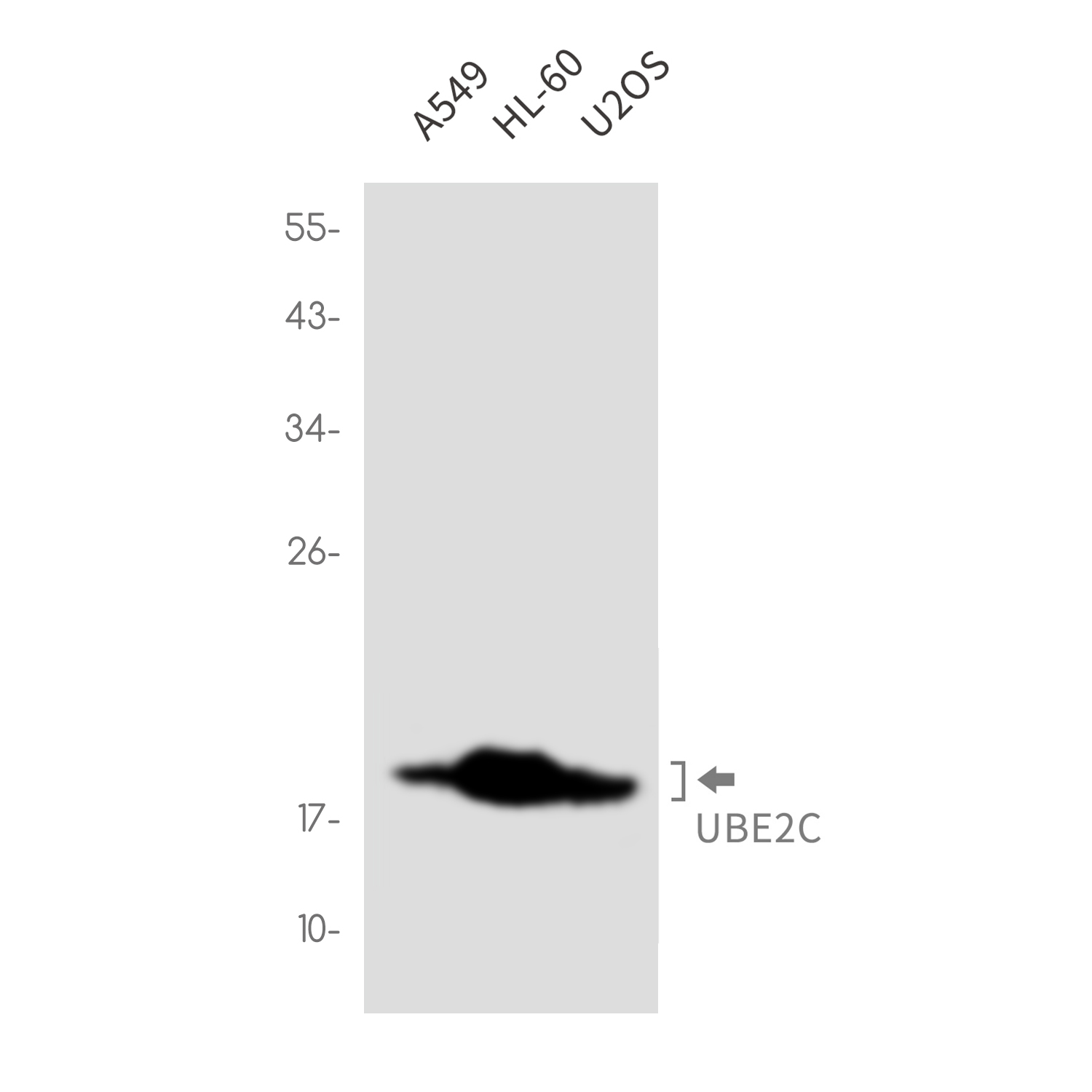 Ubiquitin Conjugating Enzyme E2 C Rabbit mAb