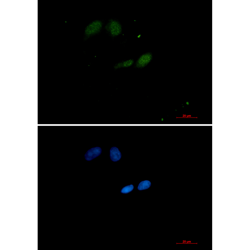 SUMO Conjugating Enzyme UBC9 Rabbit mAb