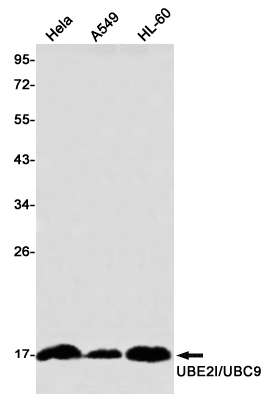 SUMO Conjugating Enzyme UBC9 Rabbit mAb