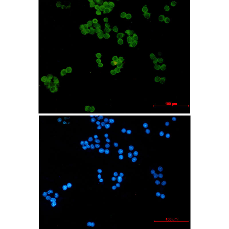 Ubiquitin Conjugating Enzyme E2 L3 Rabbit mAb