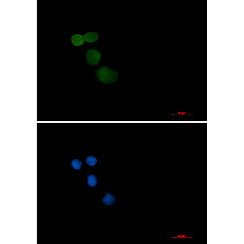 Ubiquitin Protein Ligase E3A Rabbit mAb