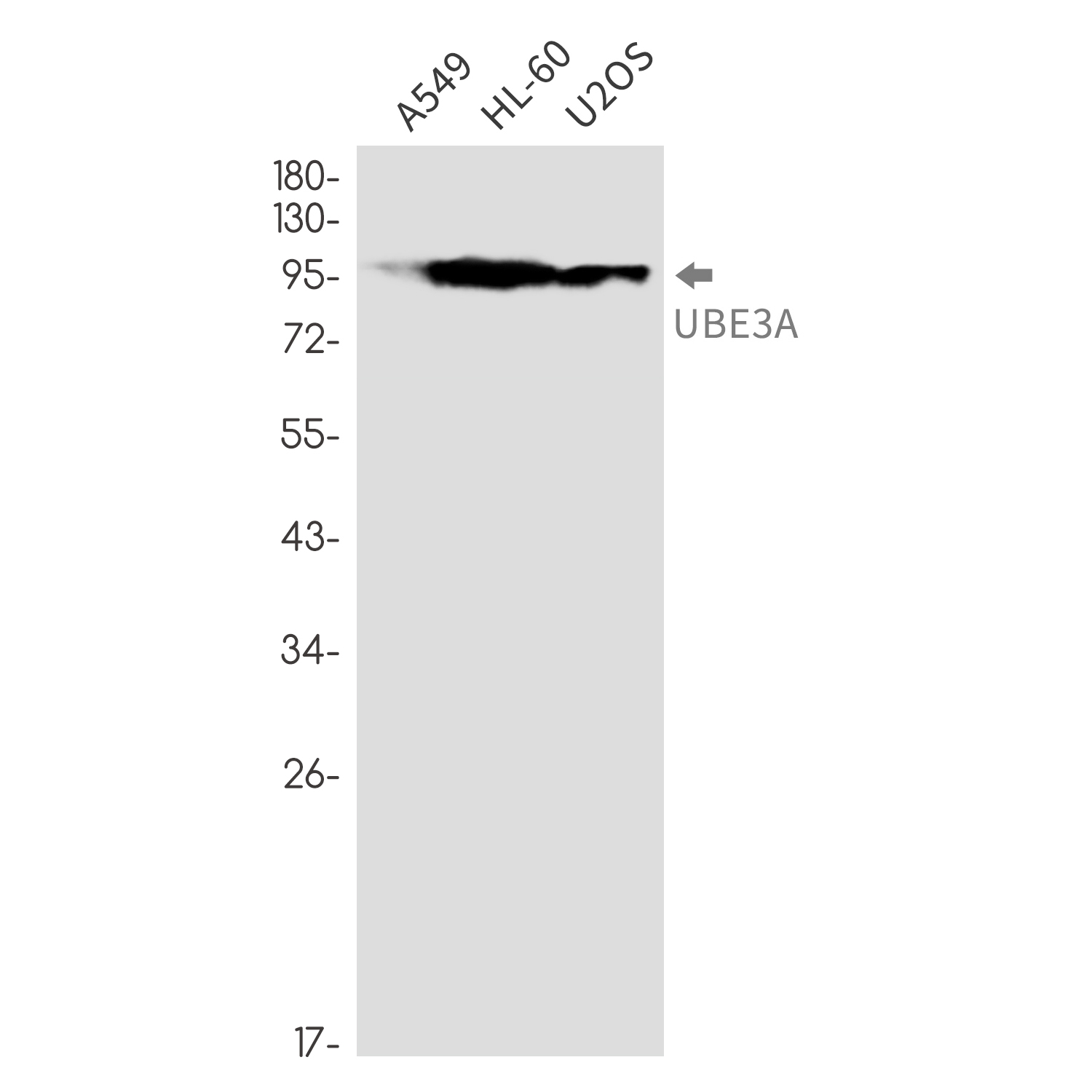 Ubiquitin Protein Ligase E3A Rabbit mAb