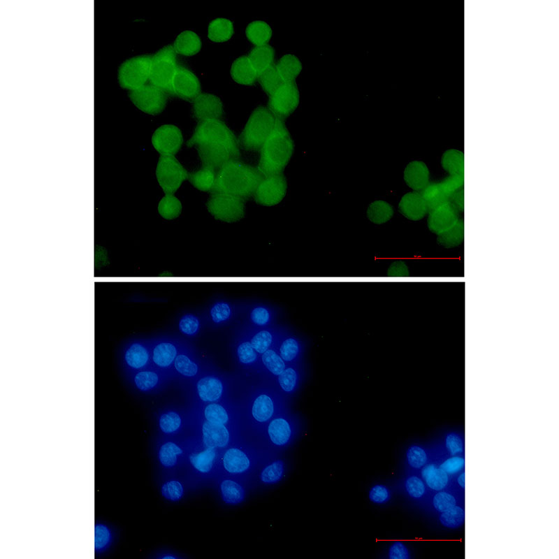 Ubiquitin K63 Rabbit mAb