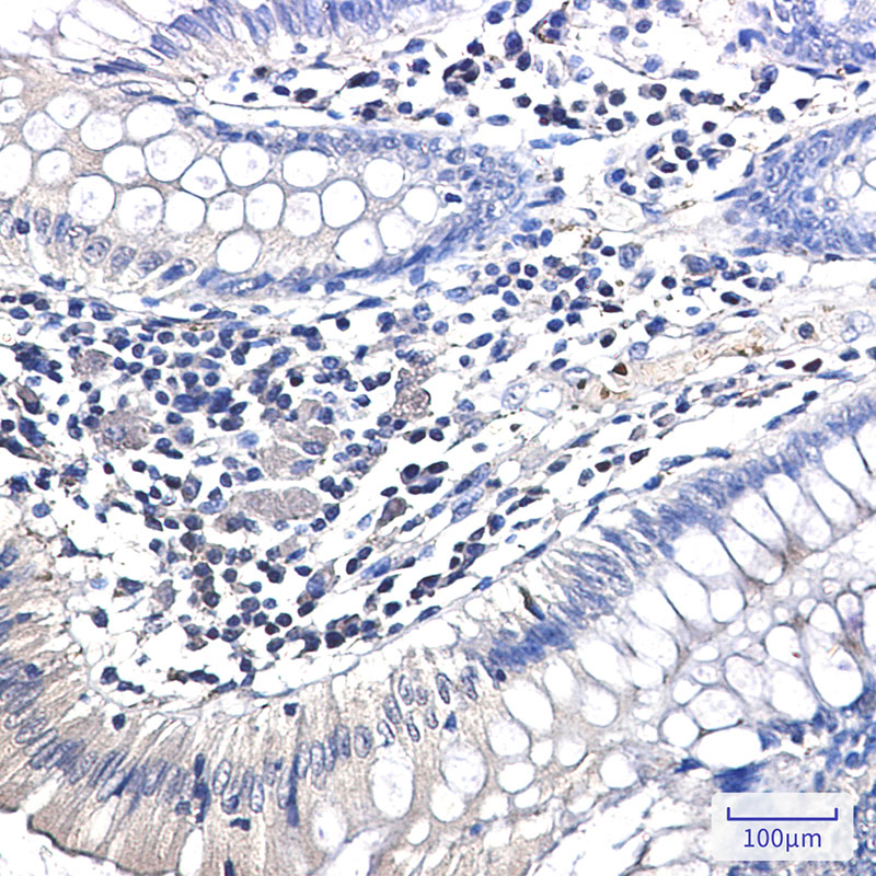 Ubiquitin K63 Rabbit mAb