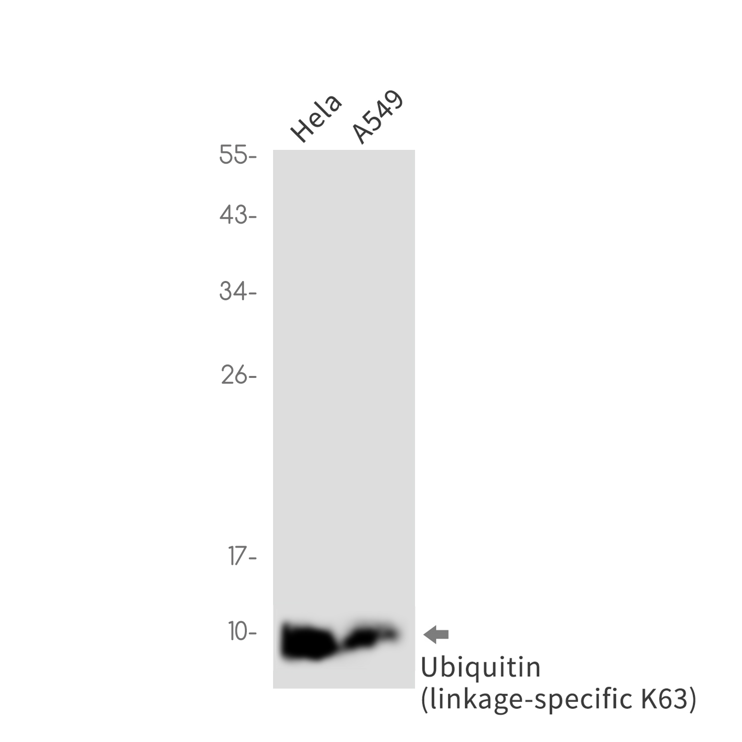 Ubiquitin K63 Rabbit mAb