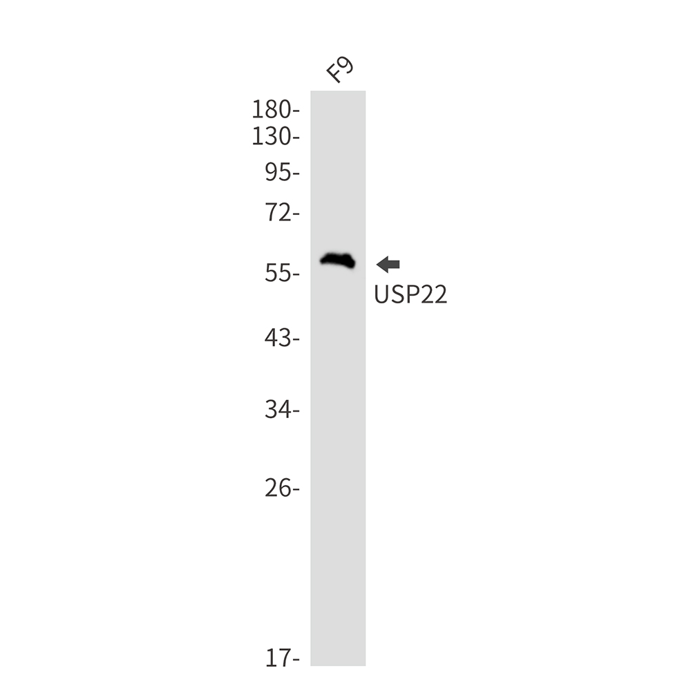 USP22 Rabbit mAb