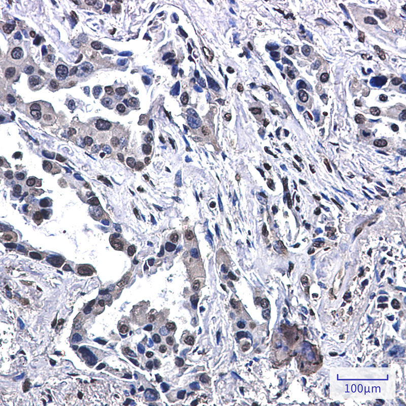 VPS35 Rabbit mAb