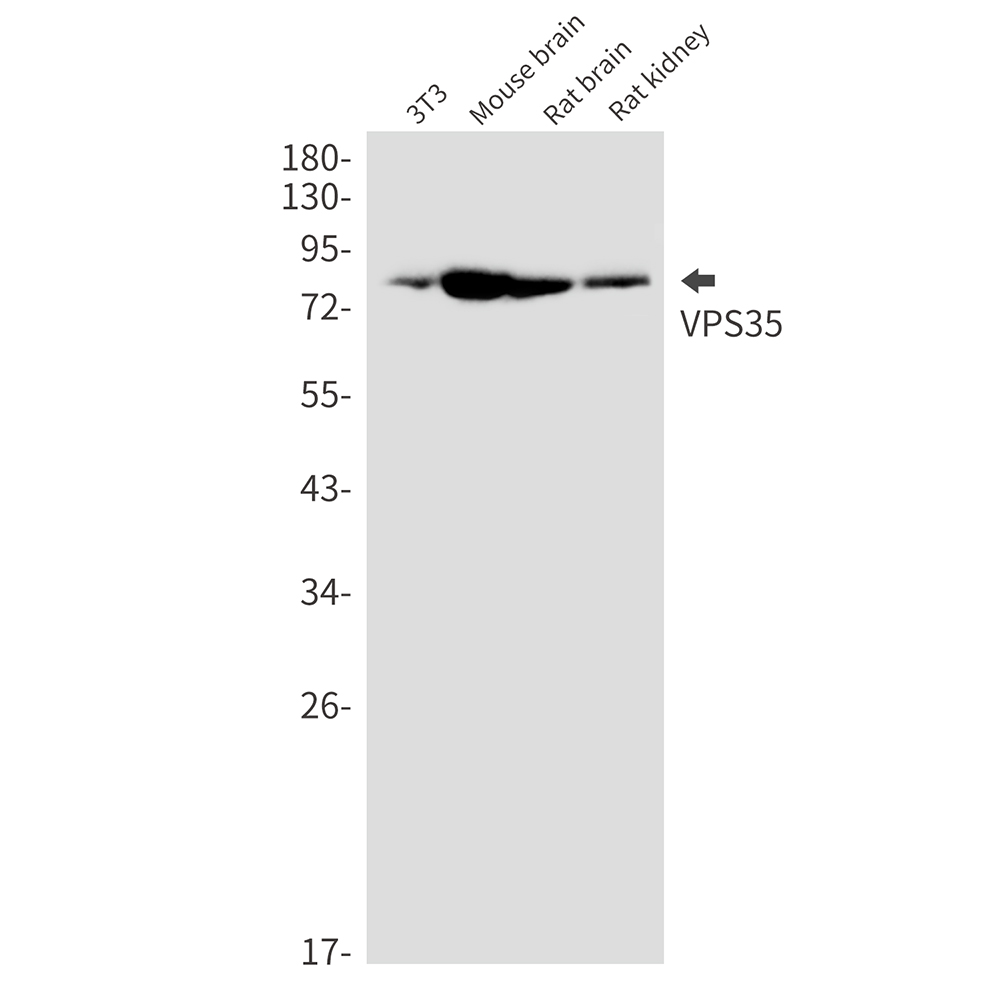 VPS35 Rabbit mAb