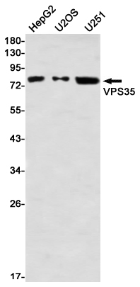 VPS35 Rabbit mAb