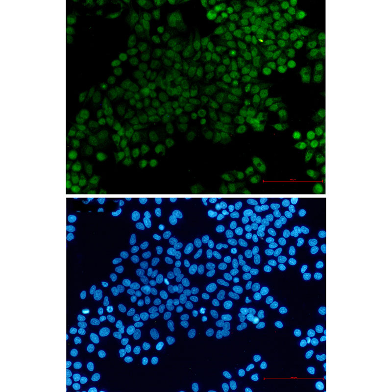 XRCC1 Rabbit mAb