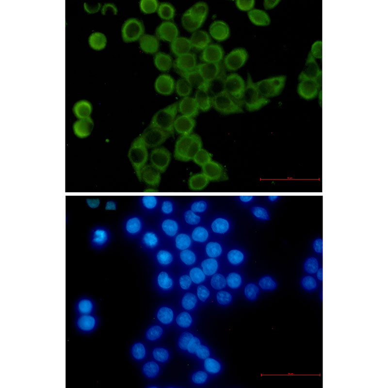 YB1 Rabbit mAb