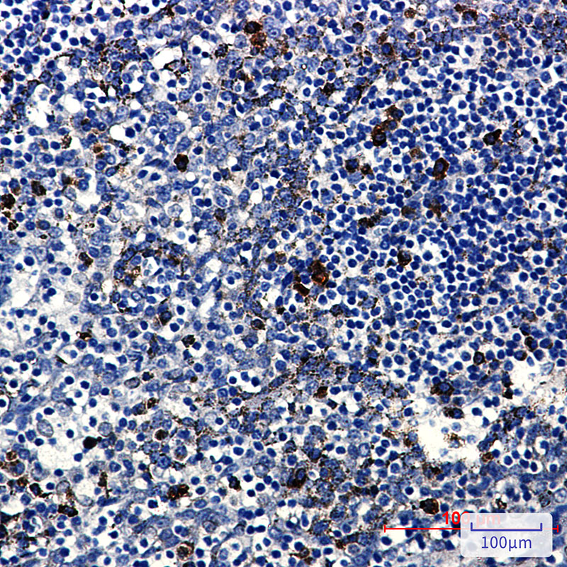 PKC beta 2 Rabbit mAb