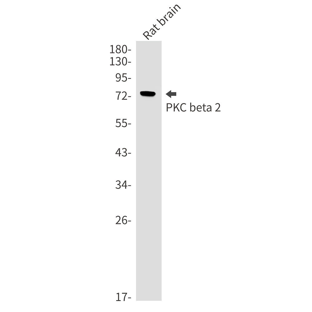 PKC beta 2 Rabbit mAb