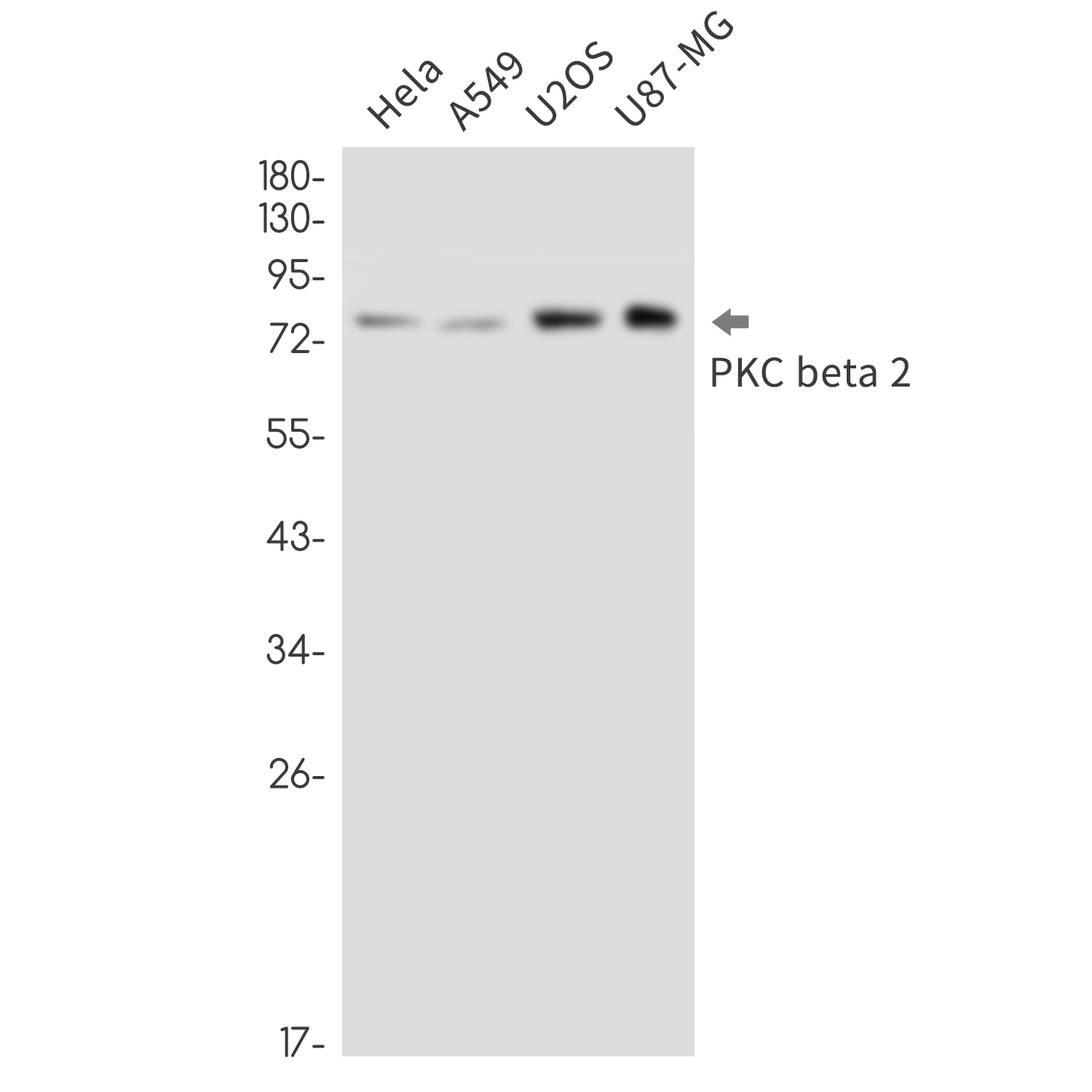 PKC beta 2 Rabbit mAb